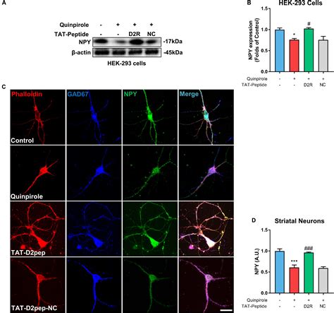 Frontiers Prevention Of Neurite Spine Loss Induced By Dopamine D