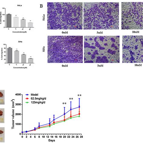 Metformin Inhibits The Migration And Invasion Of Cervical Cancer Cells Download Scientific