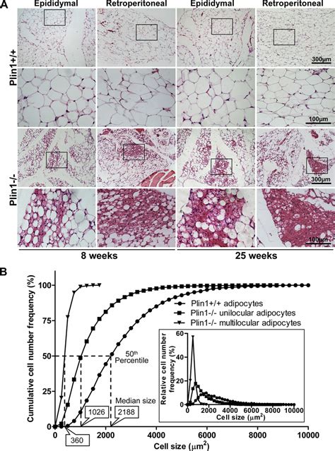 Aberrant Morphology Of Adipose Tissue In Plin Mice A Hematoxylin