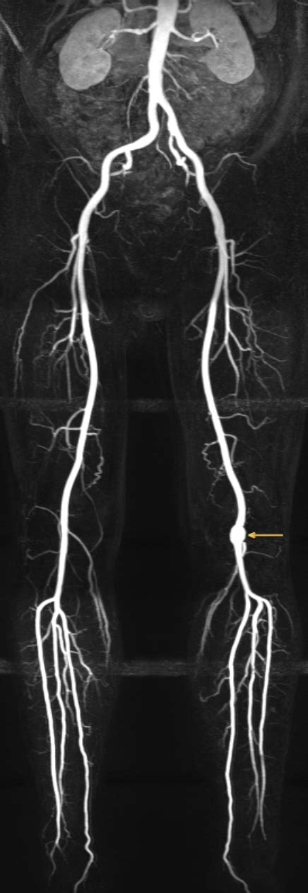 Magnetresonanztomografie Mrt Radiologie Filstal