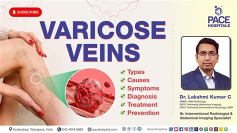 Varicose Veins Cause Symptoms Complications Treatment And