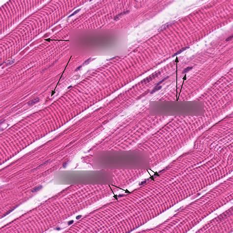 skeletal muscle tissue Diagram | Quizlet