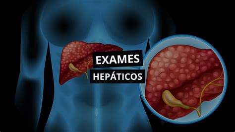 O Que Significa Hepático - Como interpretar exames hepáticos? - Cursau Educação - Blog