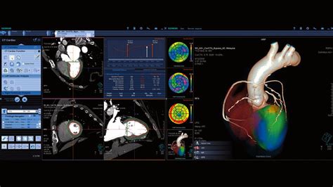 Somatom Definition Flash Siemens Healthineers Schweiz