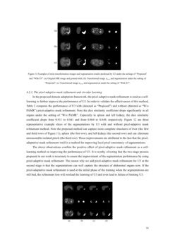 Source Free Unsupervised Domain Adaptation For Cross Modality Abdominal