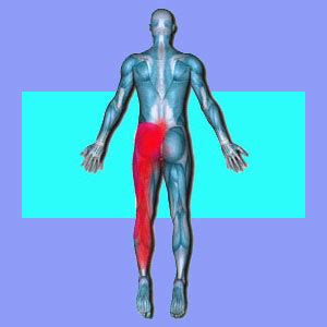 Sciatica Relief - Sciatica