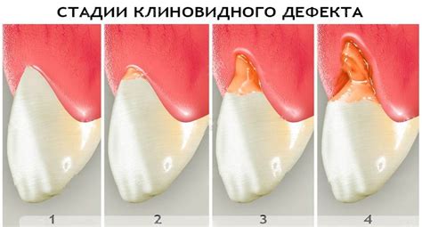 Семейная стоматология Миллениум Запись со стены Dental pictures