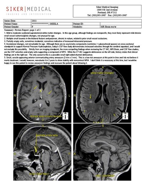 The Best Portland 3t Mri What Sets Siker Imaging Apart