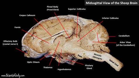 Fornix Sheep Brain Sheep Brain Dissection Project Guide Hst Learning Center