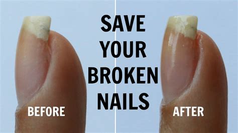 How To Fix A Broken Nail And Make It Last Youtube