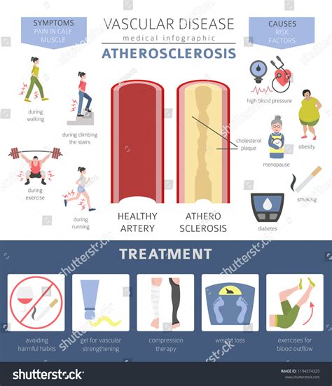 Vascular Diseases Atherosclerosis Symptoms Treatment Icon Stock Vector
