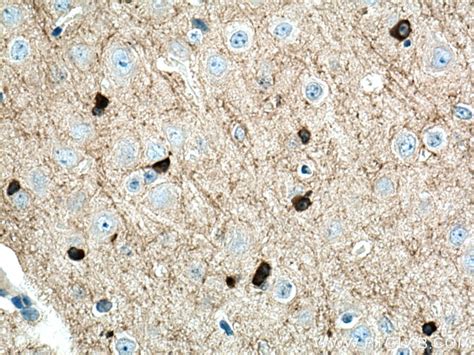 Bin1 Antibody 14647 1 Ap Proteintech