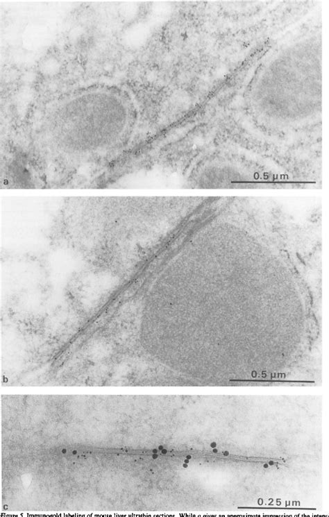 Liver Acinus Zone 1 Semantic Scholar