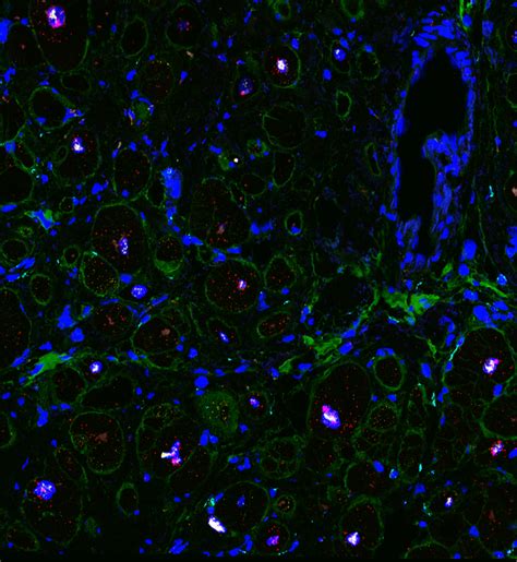 Cellular Landscape Of Cardiac Image Eurekalert Science News Releases