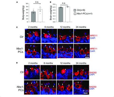 Deletion Of Nbs1 Is Compatible With Mouse Survival And Cerebellar