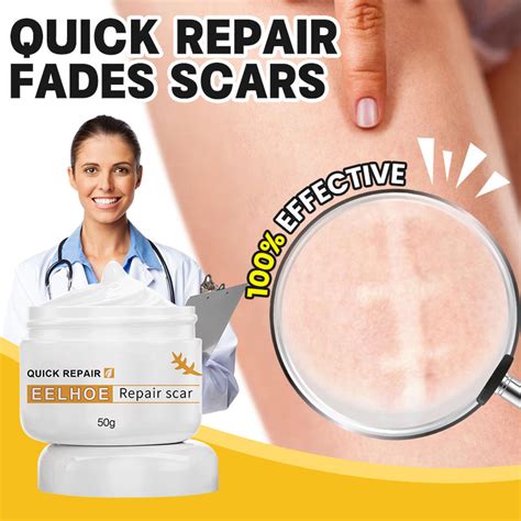 Scar Remover Peklat Scarminator Cream Strech Mark Remover Pimple For