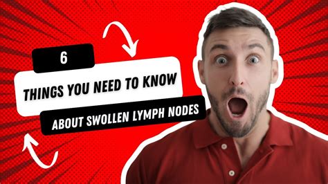 Things You Need To Know About Swollen Lymph Nodes Or Swollen Glands