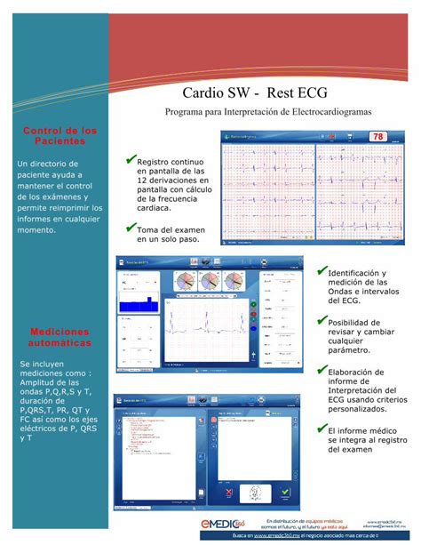 PDF Electrocardiógrafo Digital CV200y 12 derivaciones en pantalla