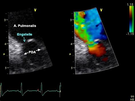 Persistierender Ductus Arteriosus Botalli Pda Tierarztpraxis Dr