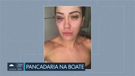 Mulher Agredida Em Porta De Boate Df G