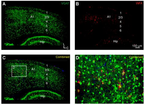 Brain Sciences Free Full Text Wisteria Floribunda Agglutinin