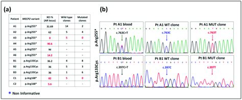 XCI Pattern And Selective Expression Of Wild Type WT And Pathogenic