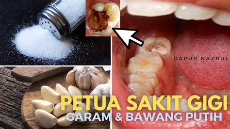 Petua Sakit Gigi Sakit Gigi Berlubang Ubat Sakit Gigi Ubat Sakit