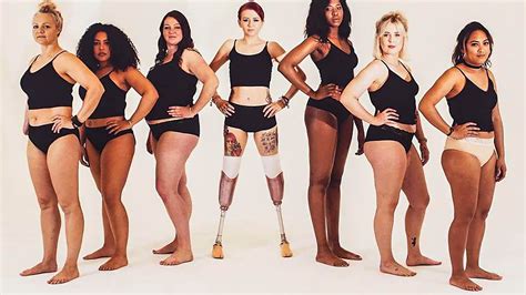 Fearless Scots Model Who Lost Both Her Legs To Deadly Flesh Eating Bug