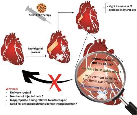 Stem Cell Therapy Heart