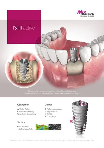 Neobiotech IS III Active Impianto Dentale SpotImplant