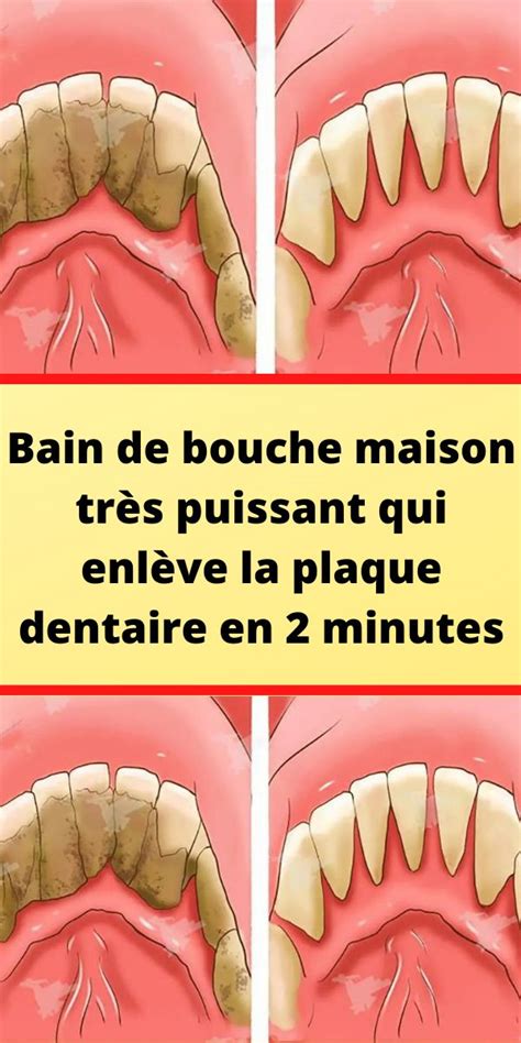 Bain De Bouche Maison Tr S Puissant Qui Enl Ve La Plaque Dentaire En