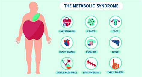 Metabool Syndroom Wat Doe Je Met Die Stofwisselingsstoornissen