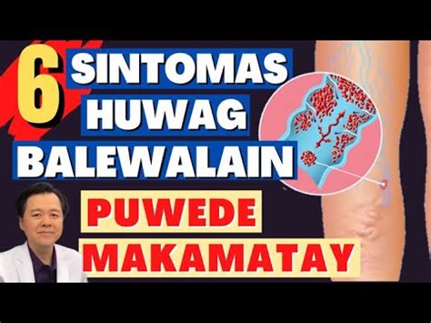 Sintomas Wag Balewalain Pwede Makamatay By Doc Willie Ong