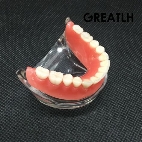 Di Overdenture I Mandibular D K Di Modeli Ile Mandibular Mplant