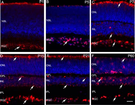 Expression Of The Mas Receptor Protein In The Mouse Retina At Different