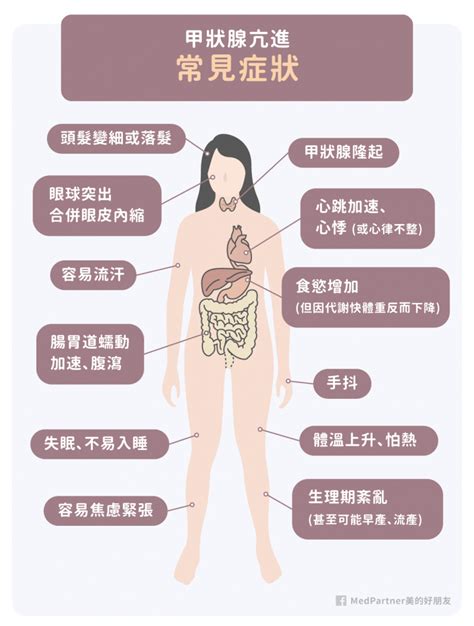 甲狀腺亢進症狀有哪些？如何治療與飲食？醫師圖文解說 美的好朋友