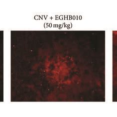 Eghb Inhibits Vegf Induced Retinal Vascular Leakage A