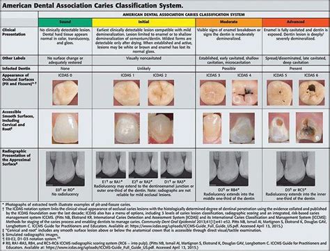 Tooth Color Chart Printable