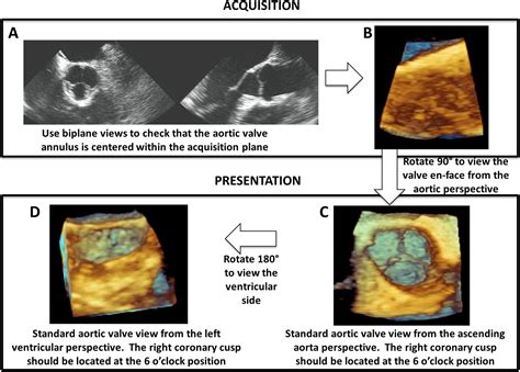 Guidelines For Performing A Comprehensive Transesophageal