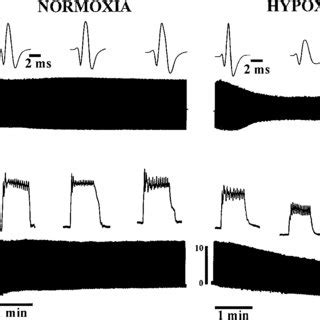 Representative Tracings Of Genioglossus GG And Hyoglossus HG