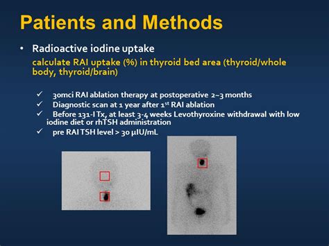 The Surgical Completeness Of Robotic Thyroidectomy A Prospective