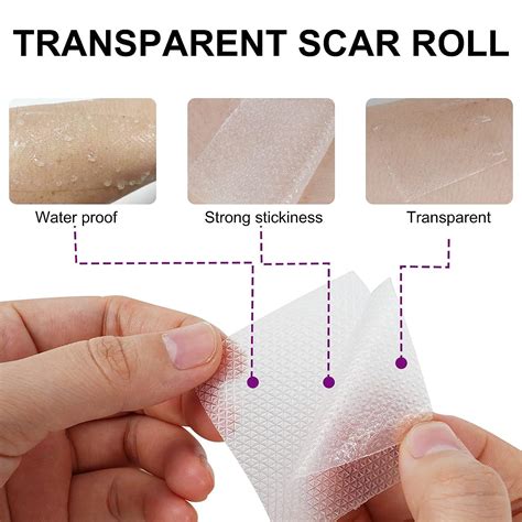 Clear Silicon Scar Sheets Scar Away Scar Tape 1 6 X 60 Roll 1 5M Scar