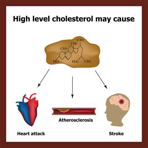 Best Foods & Essential Oils To Lower Cholesterol Naturally | Essential