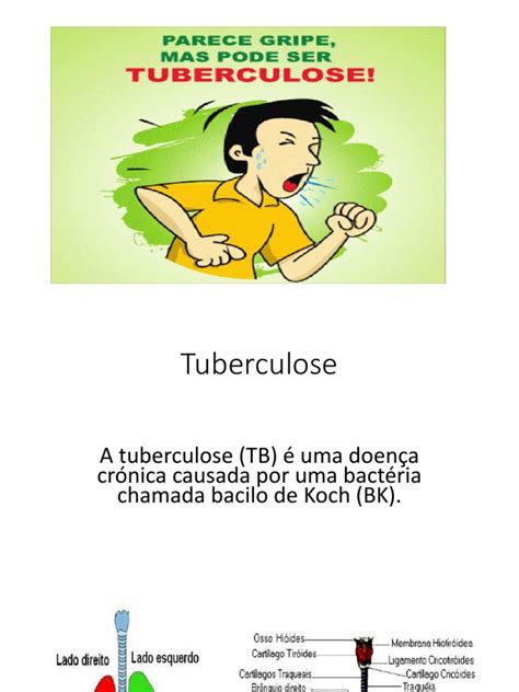 Apresentacão Sobre Tuberculose Pdf Pdf Tuberculose Pulmão