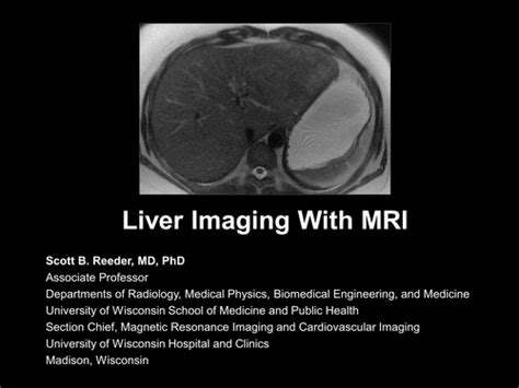 Liver Segments MRI