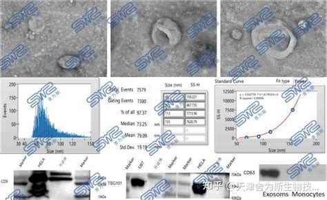 干货分享大规模细胞培养上清外泌体富集实验技巧 知乎