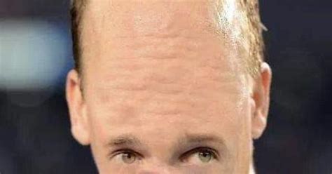 Peyton Manning’s Forehead Album On Imgur