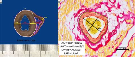 The Methods Of Gross Pathological And Histological Morphometrical