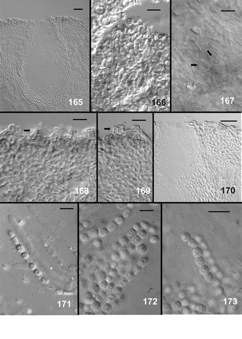 4 Page 110 Trichoderma Dorotheae Anamorph From CMD 153 154