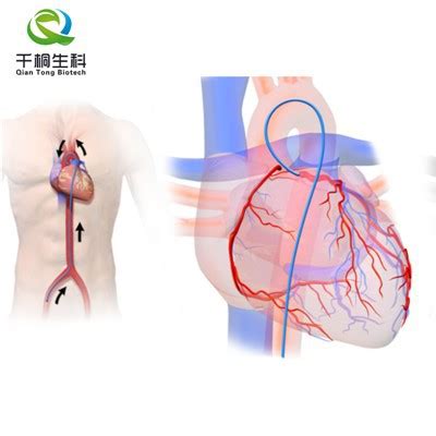 Angiography Catheter - China Angiography Catheter Manufacturers ...